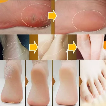 Crema de Picioare de Îngrijire Mână Anti Uscat Reparația Fisurilor Cracked Heel Anti-inflamatorii Picior Peeling Balsam Exfoliant pentru Picioare Creme