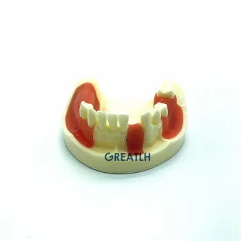 Implant dentar Practica model Maxilarul Inferior model cu dinți lipsă pentru tăiere și sutura Typodont Dinți Model cu Gingie