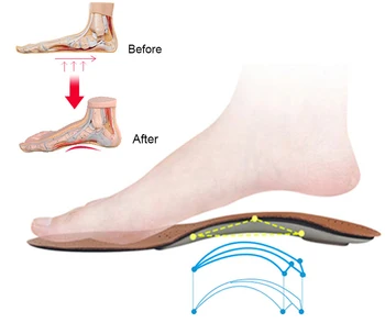 Piele Branț Ortopedice pentru Picior Plat Corector Suport Arc Ortezare Pantofi Tălpi X/O Picior de Corecție a Introduce Talpa Pad