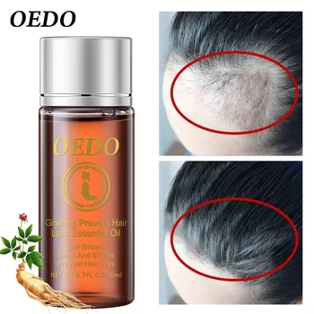OEDO 2 buc/lot de păr în creștere rapidă esență pentru chel ulei esențial de tratament, prevenirea caderii parului, tratarea în mod eficient parul uscat