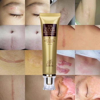LANBENA Acnee Cicatrice, vergeturi Remover Cream Skin Repair Crema de Fata pentru Acnee Tratament Pete de Albire Iluminat Melanina Crema