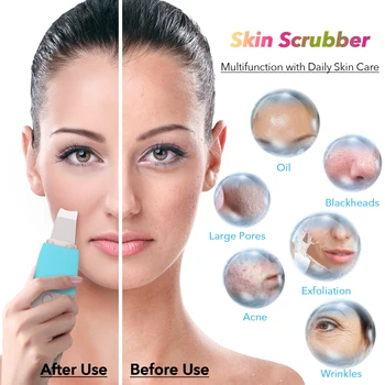 Skin Scrubber Vibrații Fata Spatula Pete Remover Faciale Scruber Lopata Curat Cavitație Peeling Facial De Ridicare