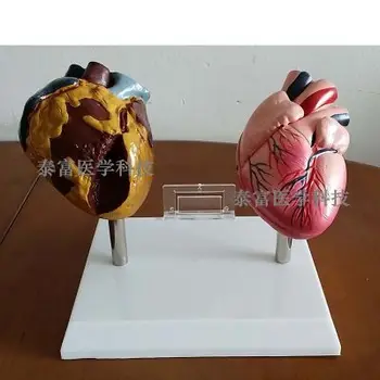 Inima omului model fumatul dauneaza model de educație patologică inima de cumpărături gratuit