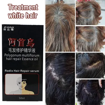 Pur medicina Chineză preparată permanent parul negru elimina permanent parul alb preveni pierderea parului Hair & Scalp Tratament