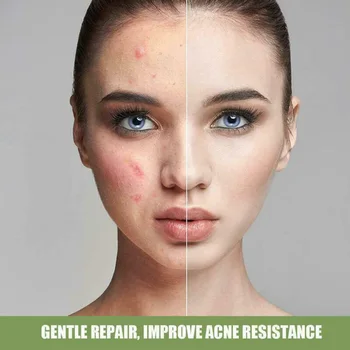 Acid salicilic Ultra Masca de Curatare inghetata Masca Faciala Reduce Semne de Acnee și puncte Negre Hidratare MH88