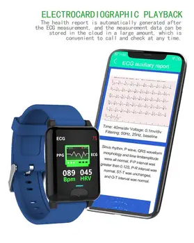 Ceas inteligent de Temperatura Corpului, Rata de Respirație Detectarea Brățară Bărbați Femei Sport Impermeabil Smartwatches AI diagnostic medical Nou