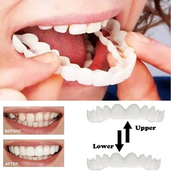 2021 nou zâmbet bretele dinți dinți bretele ortodoncia bretele Loc teeeh albire simulare bretele fixați pe zâmbet superior și joasă