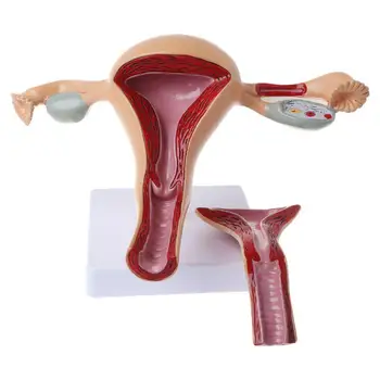 Patologice umane Uter Ovar Model Anatomic de Anatomie Patologia Bolii Medicale Leziune instrumente de Predare