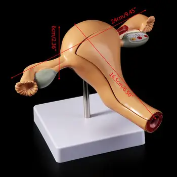 Patologice umane Uter Ovar Model Anatomic de Anatomie Patologia Bolii Medicale Leziune instrumente de Predare